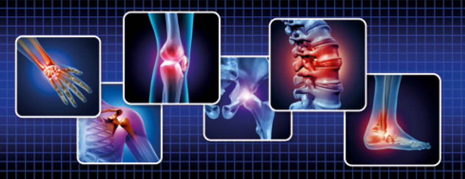 Rheumatologische Erkrankungen - Praxisupdate für die Hausärzte 2026